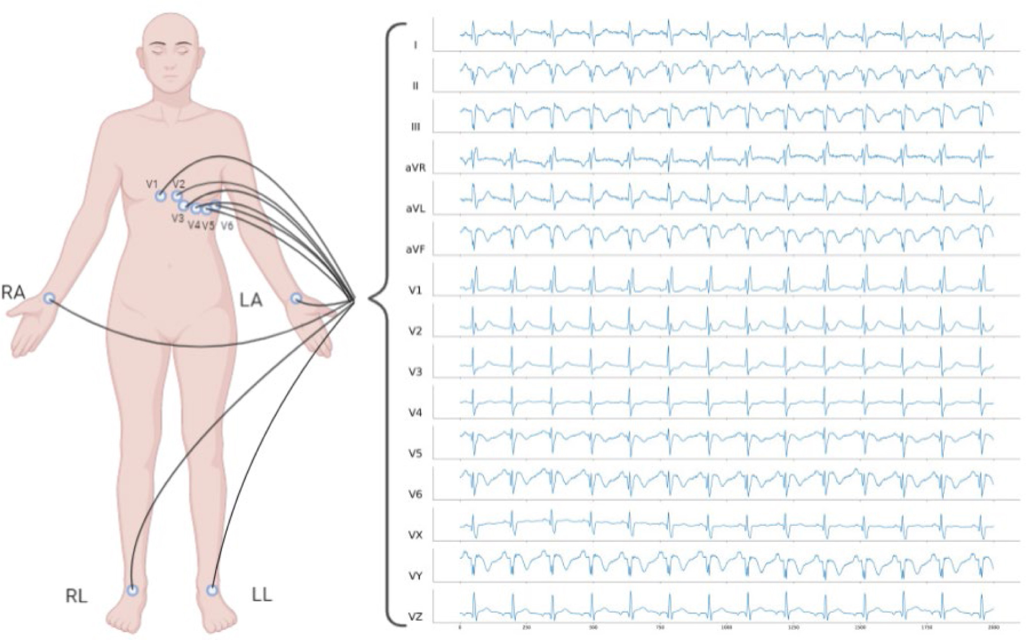 ECG Image